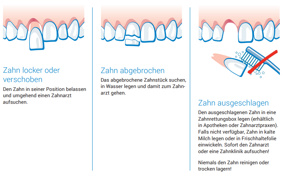 Grafik: Zahnunfall - was tun